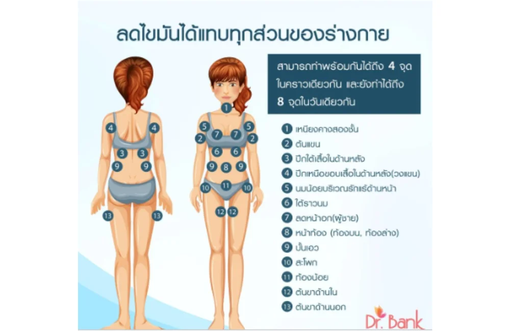 Cooltech สามารถทำได้บริเวณไหนบ้าง