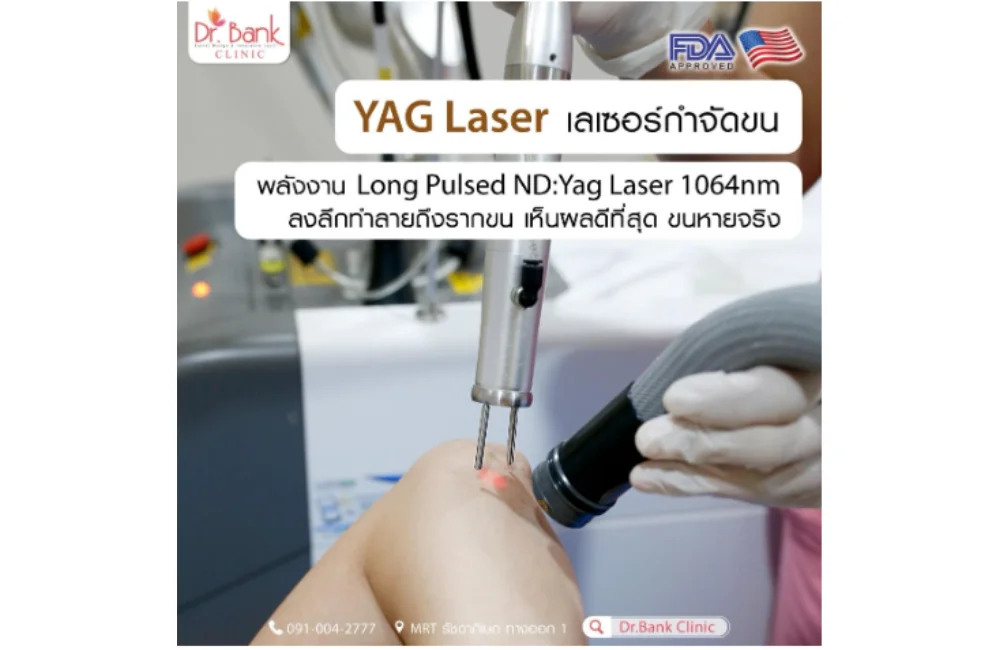 เลเซอร์รักแร้ที่ Dr. Bank Clinic