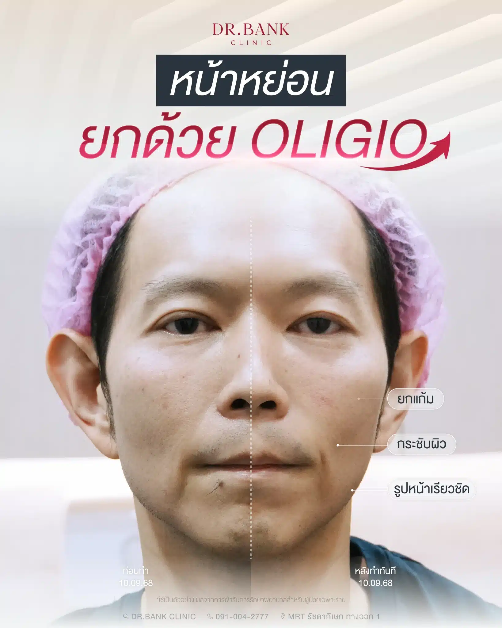 รีวิวทำ Oligio