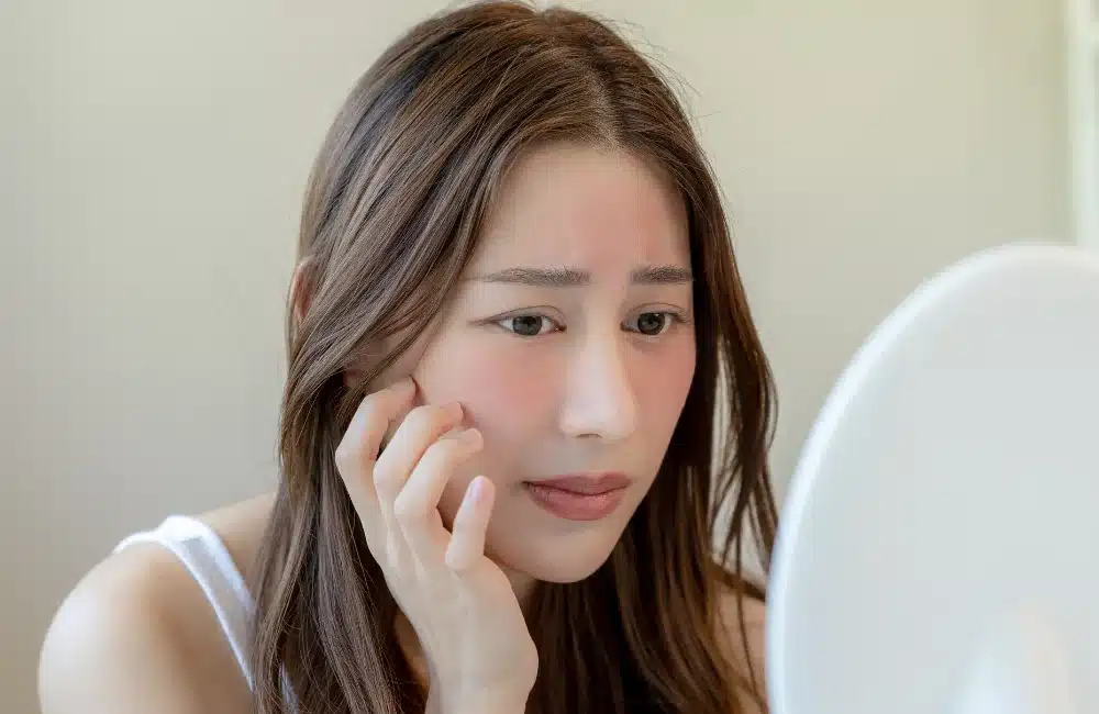 หน้าดำแดดแก้ยังไง